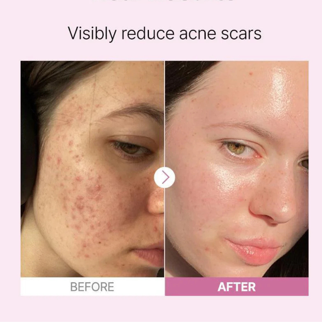 The Niacinamide 15 Serum 20ml