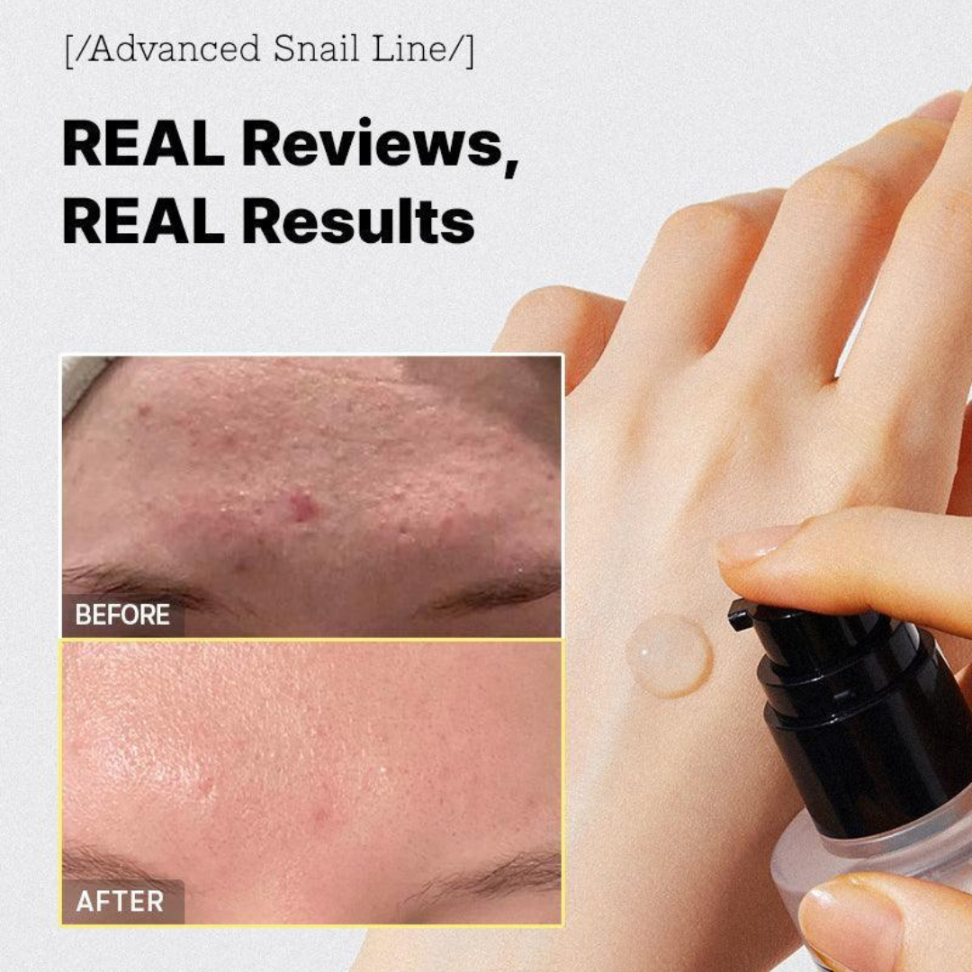 Cosrx Advanced Snail 96 Mucin Power Essence κορεατικός ορός προσώπου με έκκριμα σαλιγκαριού για ενυδάτωση και ανάπλαση.