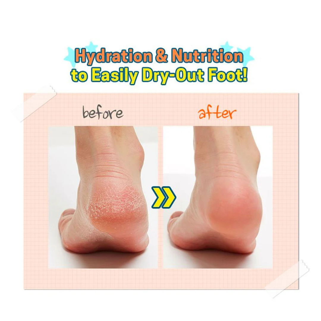 A'pieu Soft Foot Peeling Socks 40ml