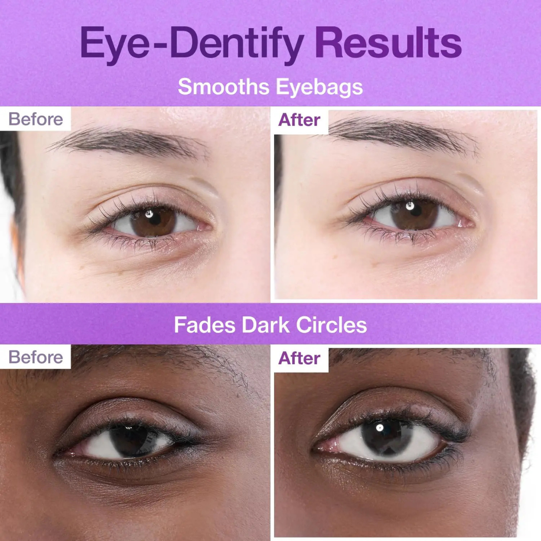 Numbuzin under eye patches για ρυτίδες και σακούλες